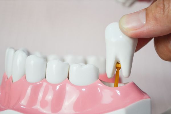 Удаление и установка зуба