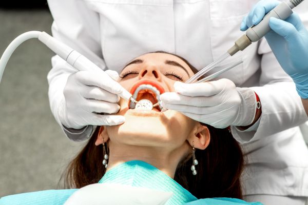 Чистка зубов в стоматологии